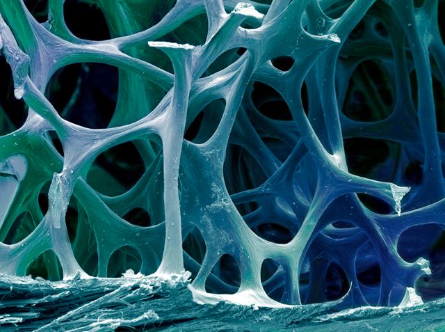 Bone Health