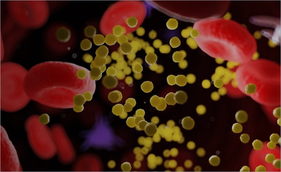 Repatha® (evolocumab)