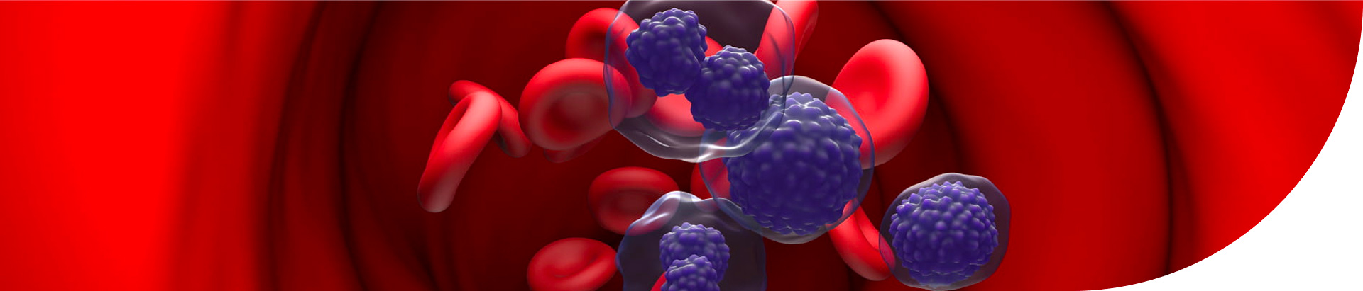 D_heamatology-multiple-myeloma