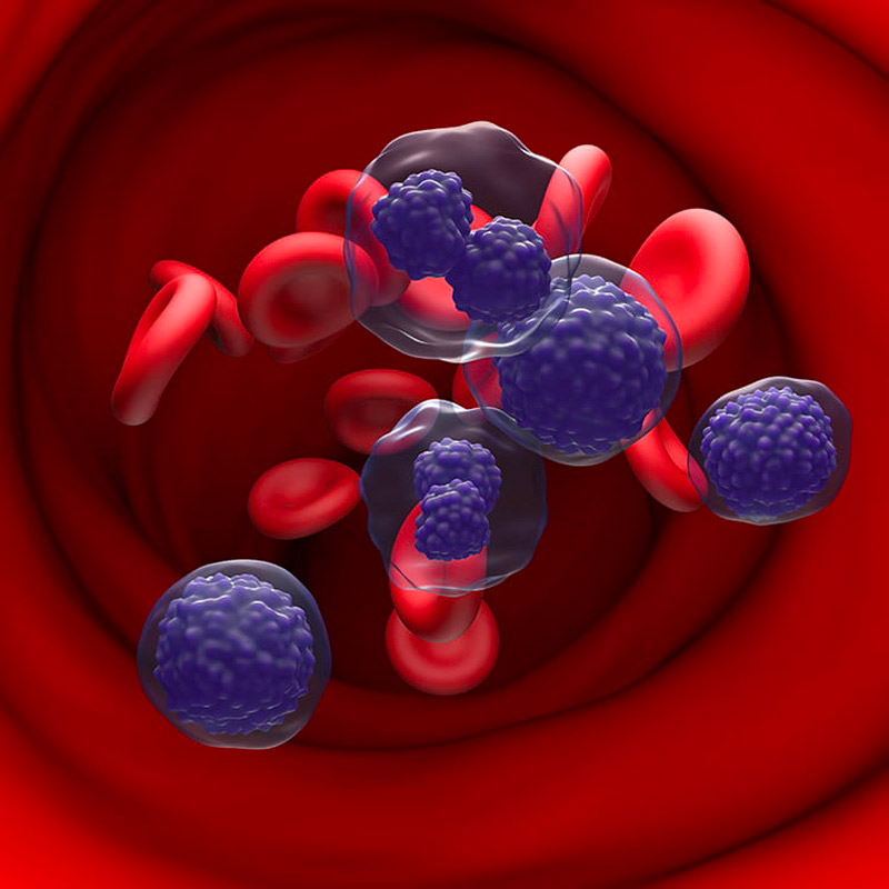 D_heamatology-multiple-myeloma
