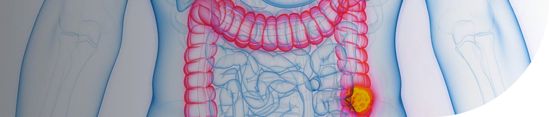 Red colon-rectum on white-blue background