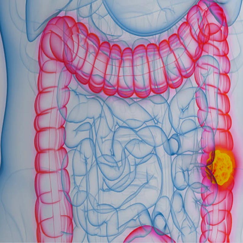 Red colon-rectum on white-blue background